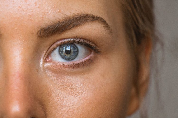 Acne bestrijden geheim
